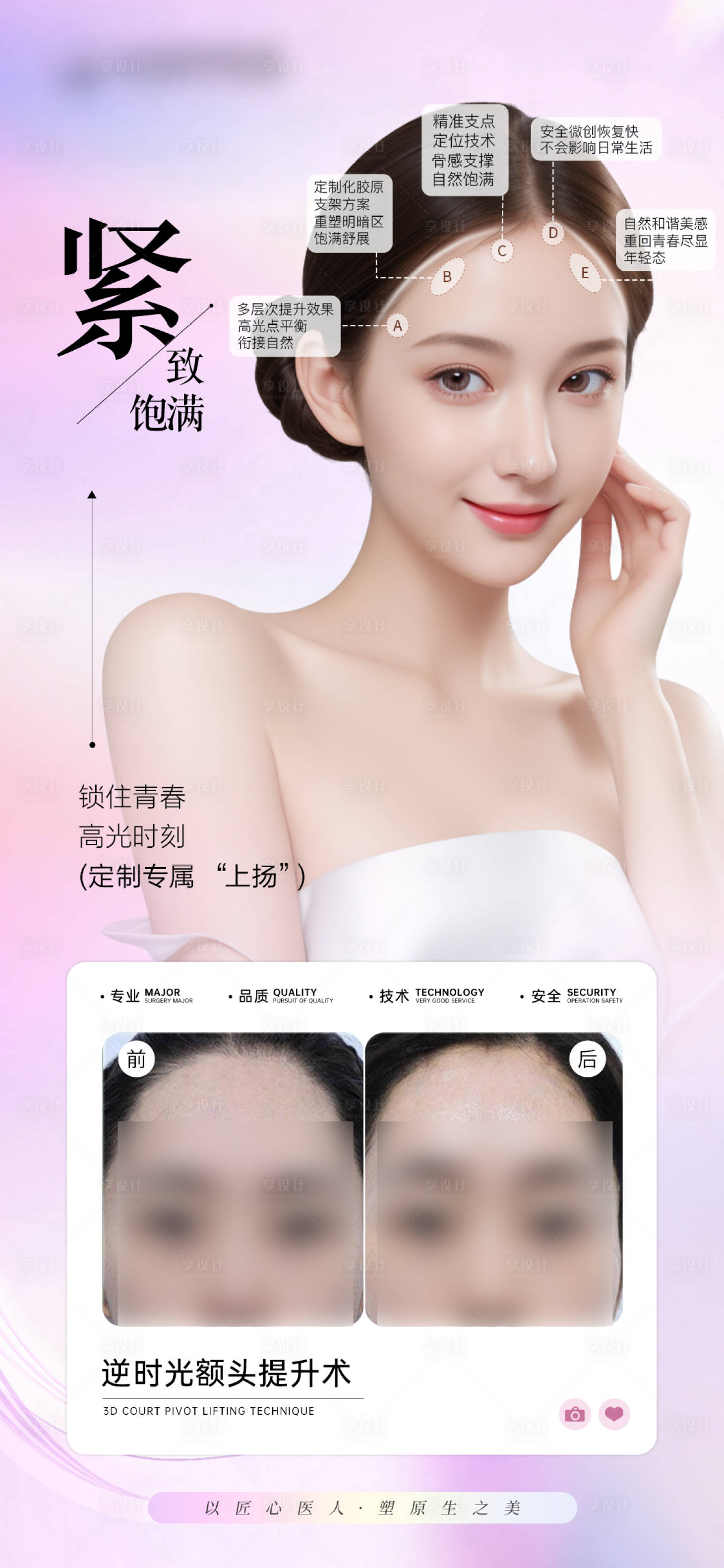 源文件下载【享设计】搜索编号：89130031239814411【医美额头提升案例对比】