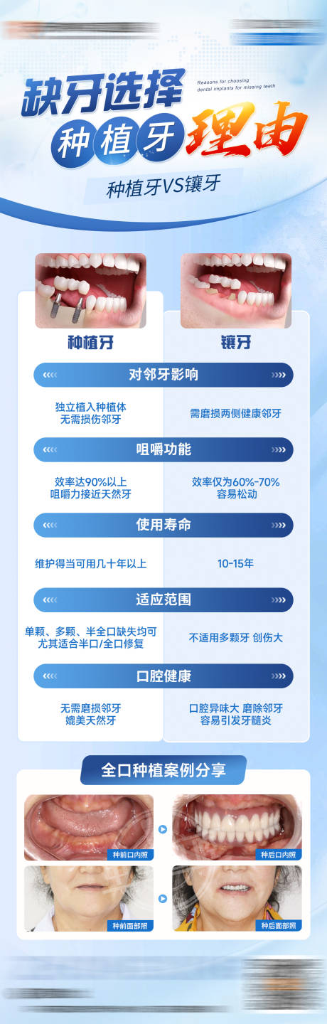 源文件下載【缺牙選擇種植牙的理由】編號：90320031505108779