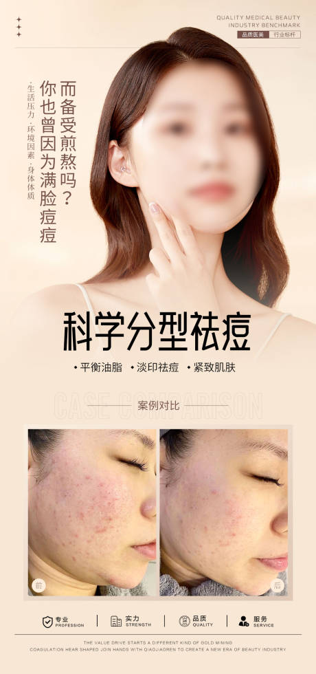源文件下載【享設(shè)計】搜索編號：73540031493508170【祛痘案例對比海報】