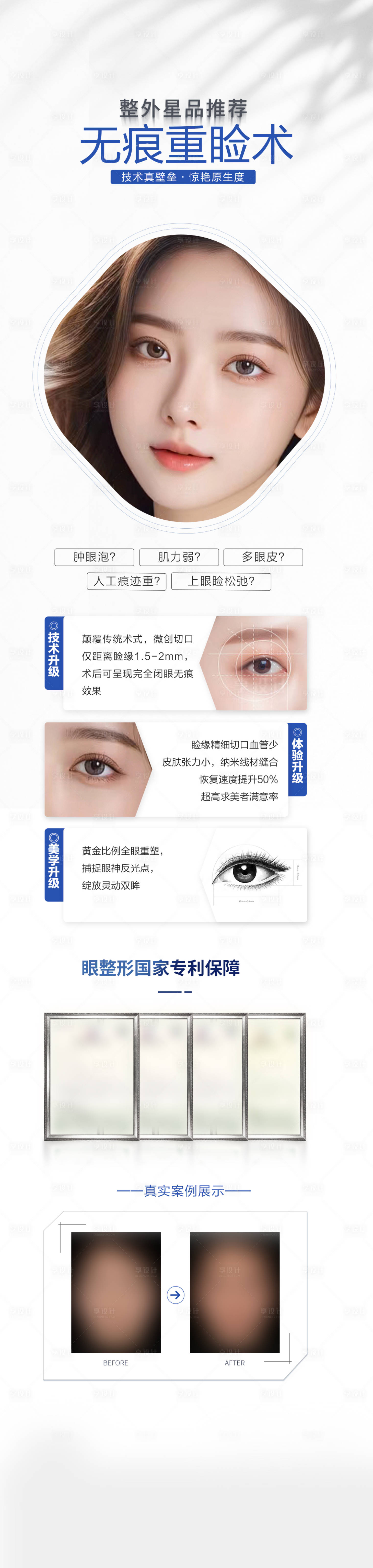 源文件下载【无痕双眼皮术海报】编号：33290031208041523
