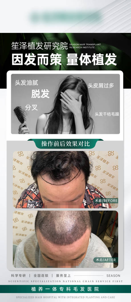 源文件下载【医美植发案例对比海报】编号：95330031401514332