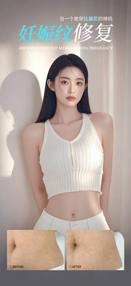 妊娠纹修复海报