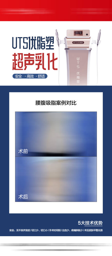 源文件下載【優脂塑案例對比】編號：24720031588199718