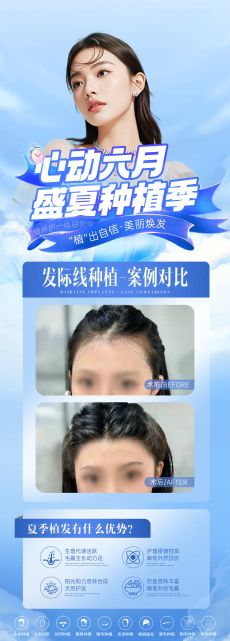 源文件下載【醫美夏季植發案例活動長圖海報】編號：66890031379574116
