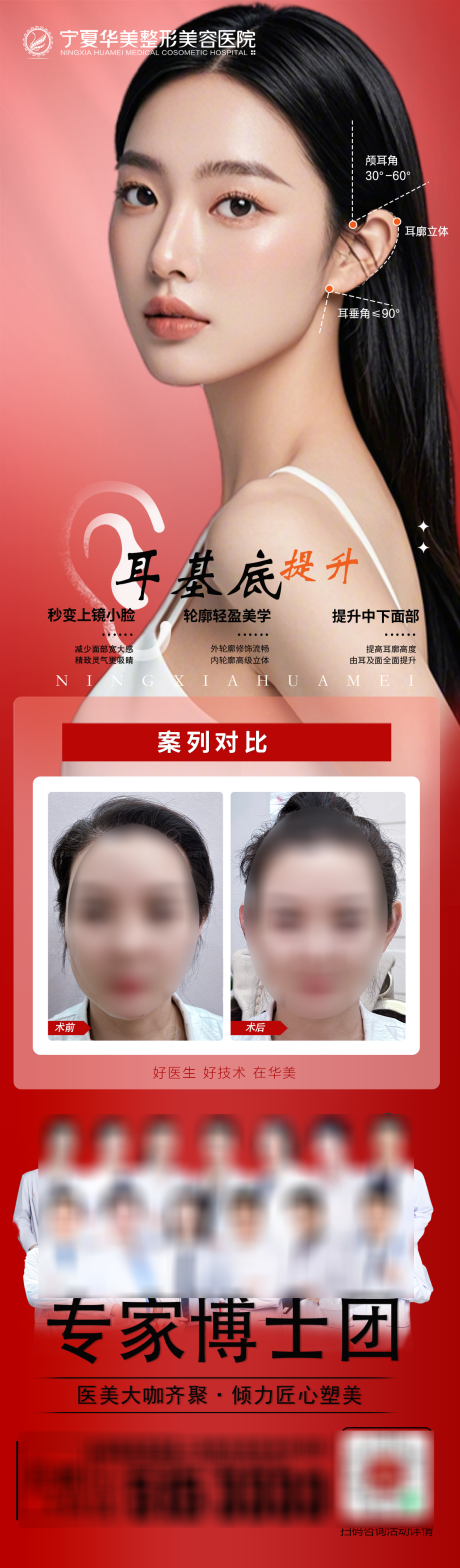 医美精灵耳案例专家长图