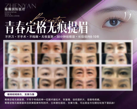源文件下载【医美无痕提眉案例海报】编号：34310031645002271