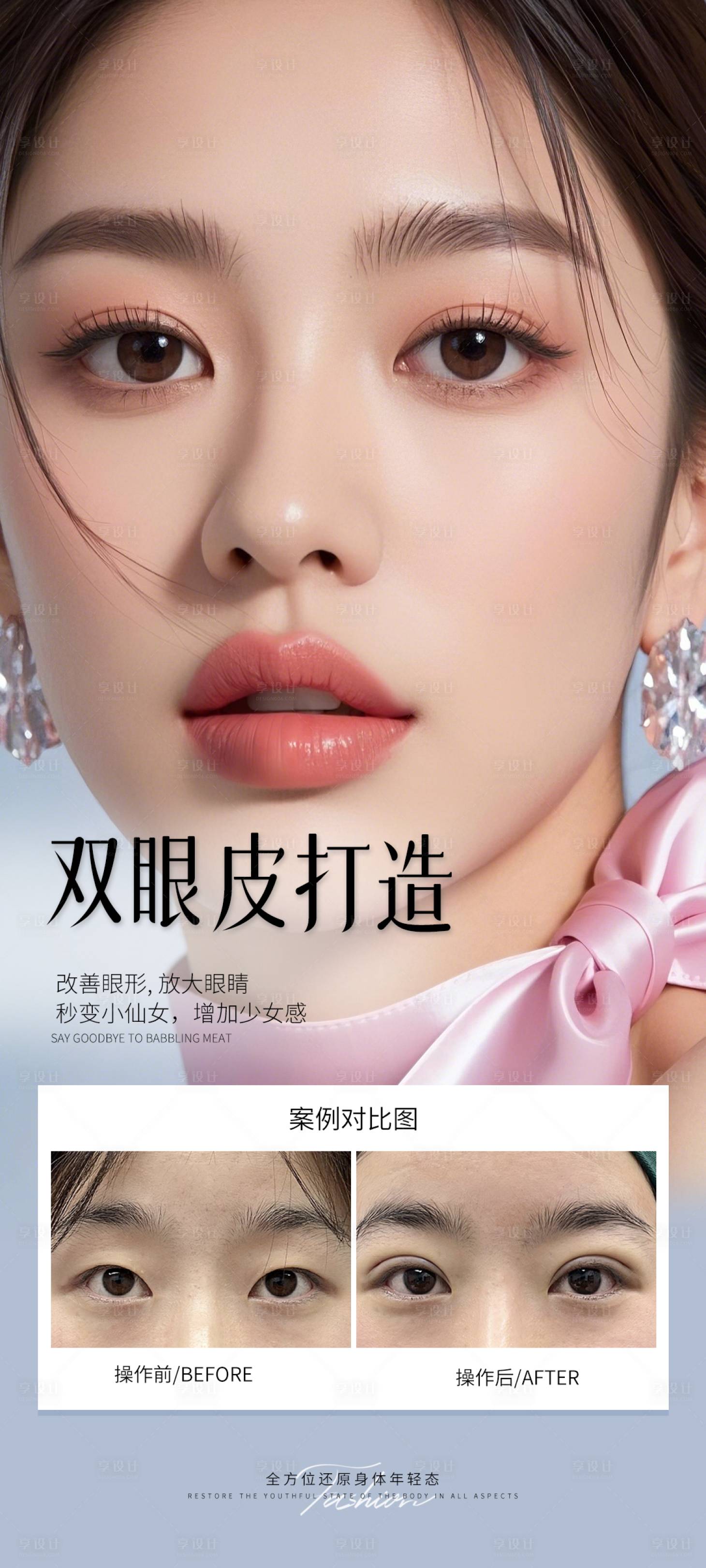 源文件下载【医美双眼皮打造案例海报】编号：37160031096009375