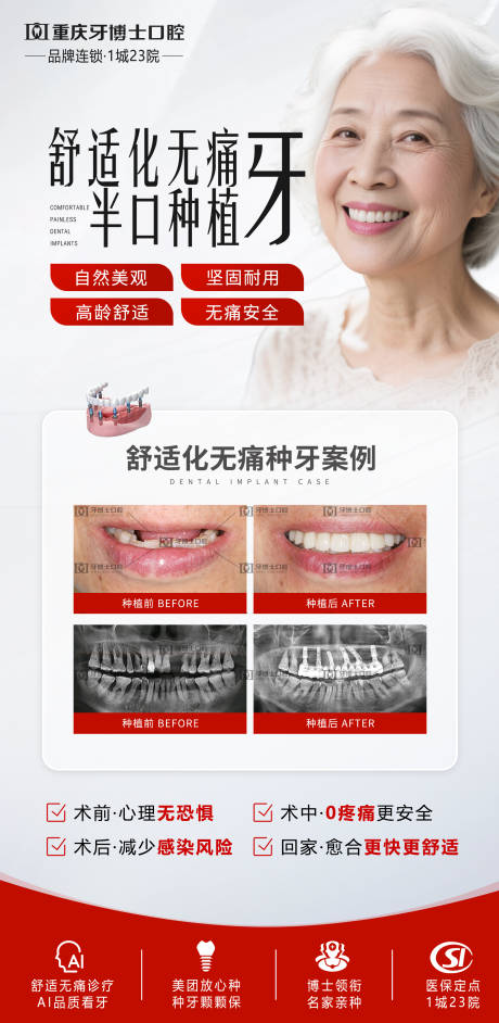 源文件下载【舒适化无痛种植牙宣传海报】编号：39000031262766203