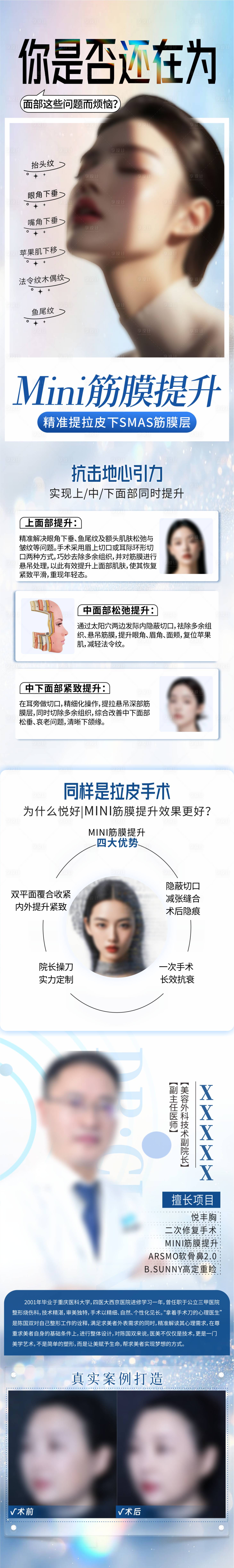 源文件下載【享設(shè)計】搜索編號：14670031406428534【MINI筋膜提升】