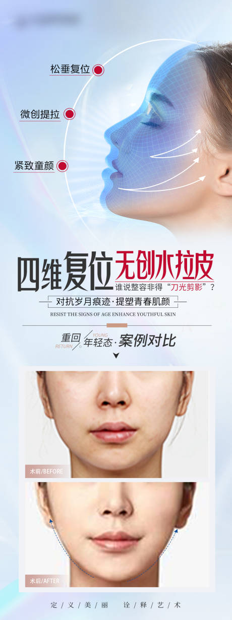 源文件下载【医美全面部拉皮案例海报】编号：97620031239646327