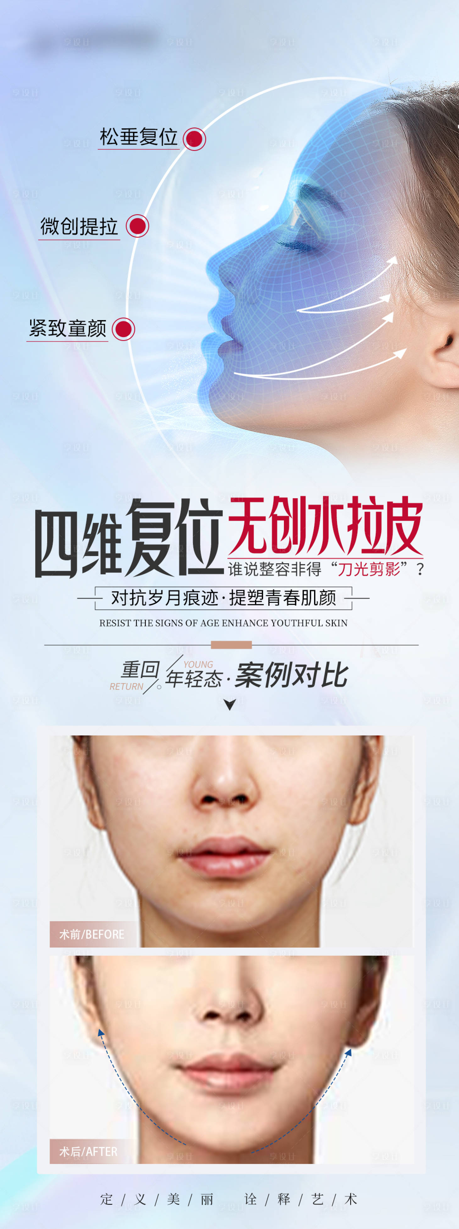 源文件下載【享設計】搜索編號：97620031239646327【醫美全面部拉皮案例海報】