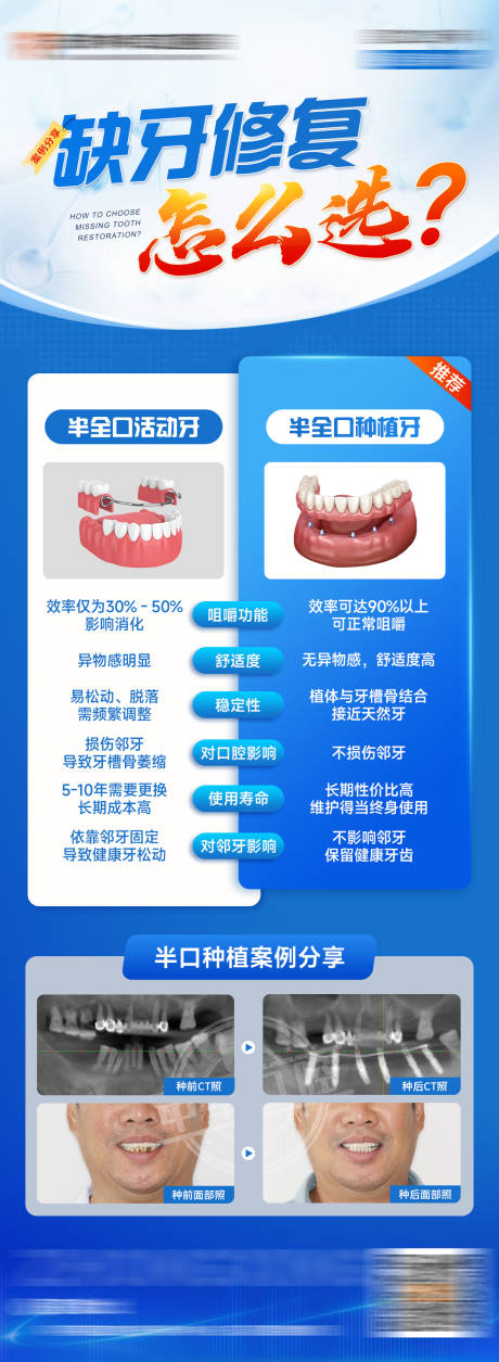 源文件下載【缺牙修復怎么選海報】編號：73250031503877066