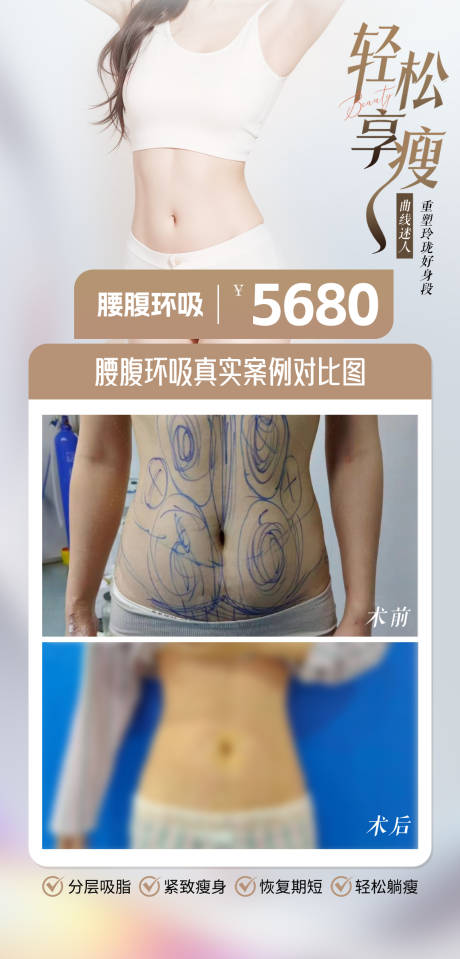 源文件下载【腰腹环吸】编号：27590031329978594