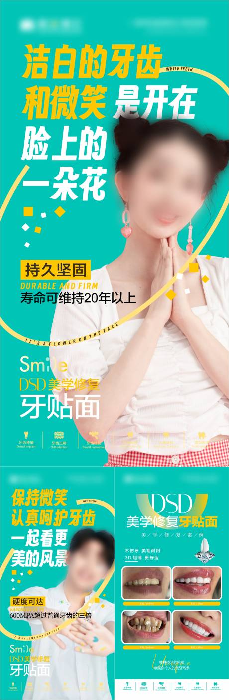 源文件下载【牙贴面美牙】编号：10090031620932291