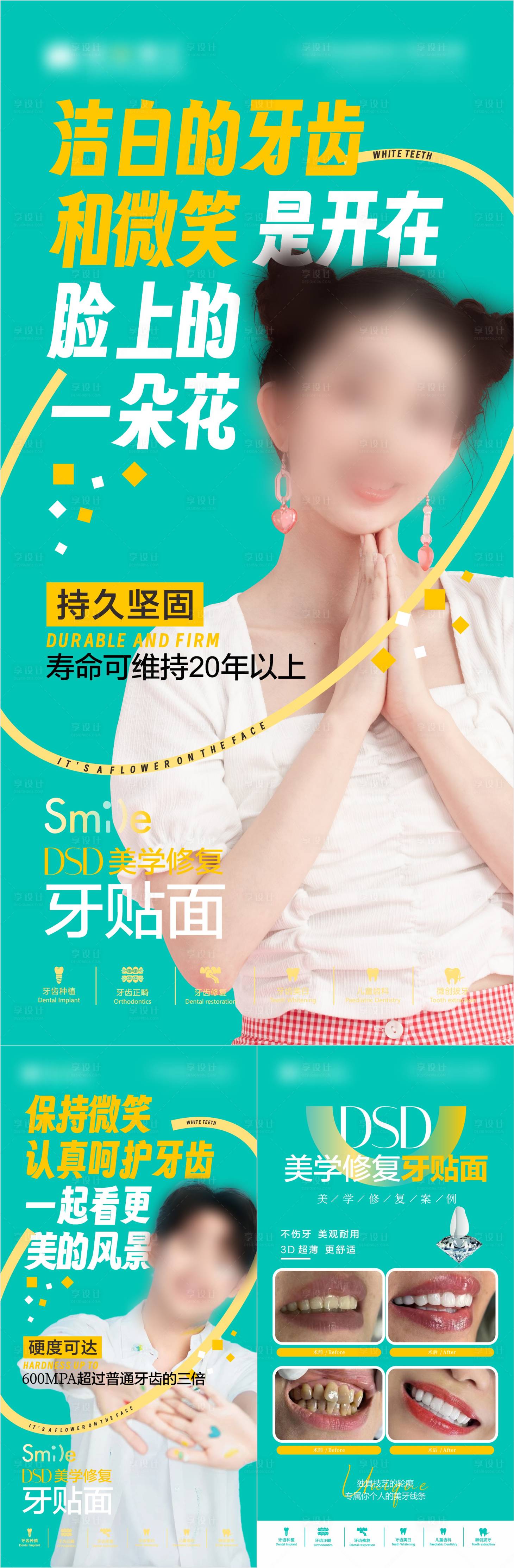 源文件下載【享設(shè)計(jì)】搜索編號(hào)：10090031620932291【牙貼面美牙】