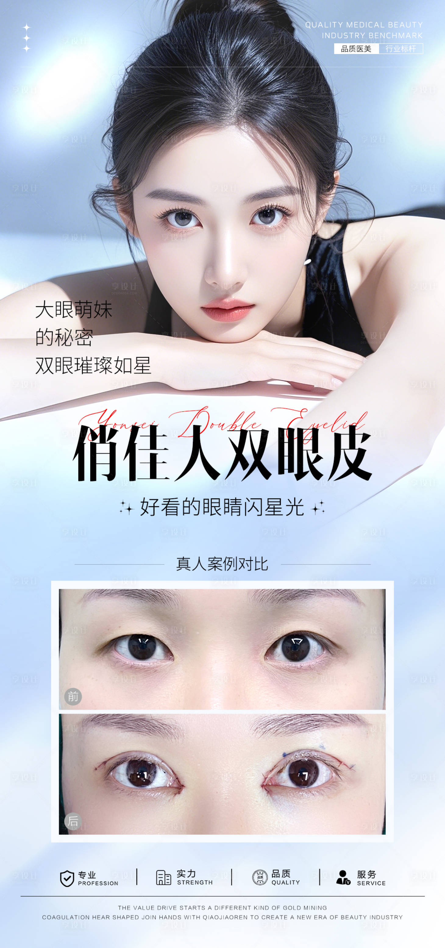 源文件下載【享設計】搜索編號：81720031609871836【雙眼皮案例海報】
