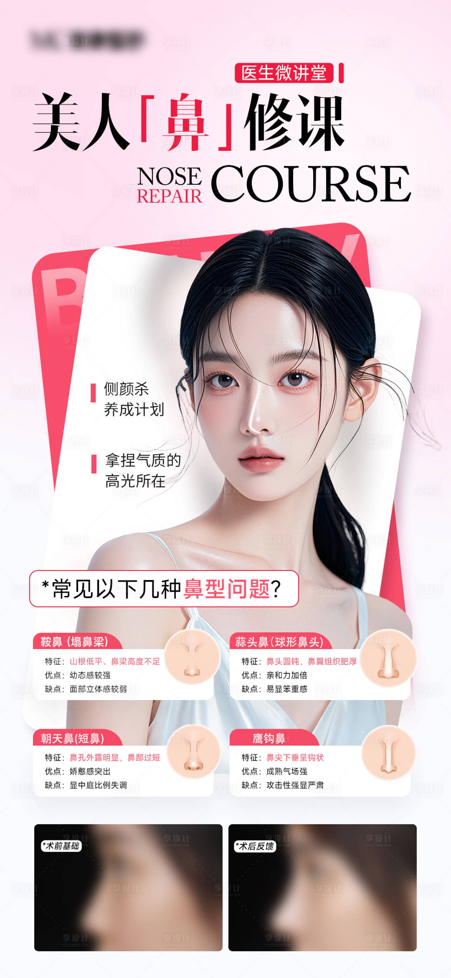 源文件下载【享设计】搜索编号：51540031459348742【医美鼻整形科普海报】