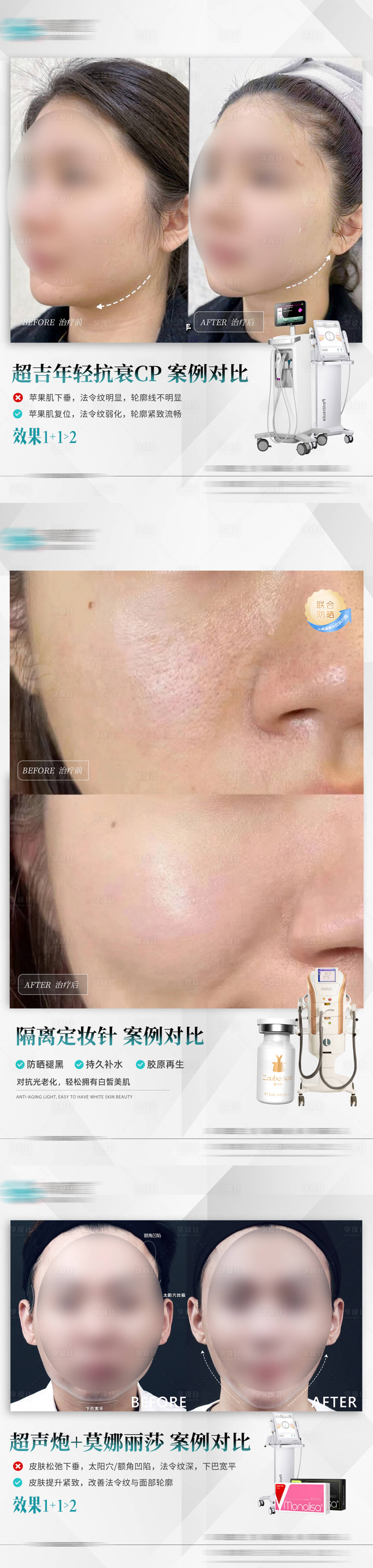 源文件下载【享设计】搜索编号：54120031185987785【医美联合项目案例】