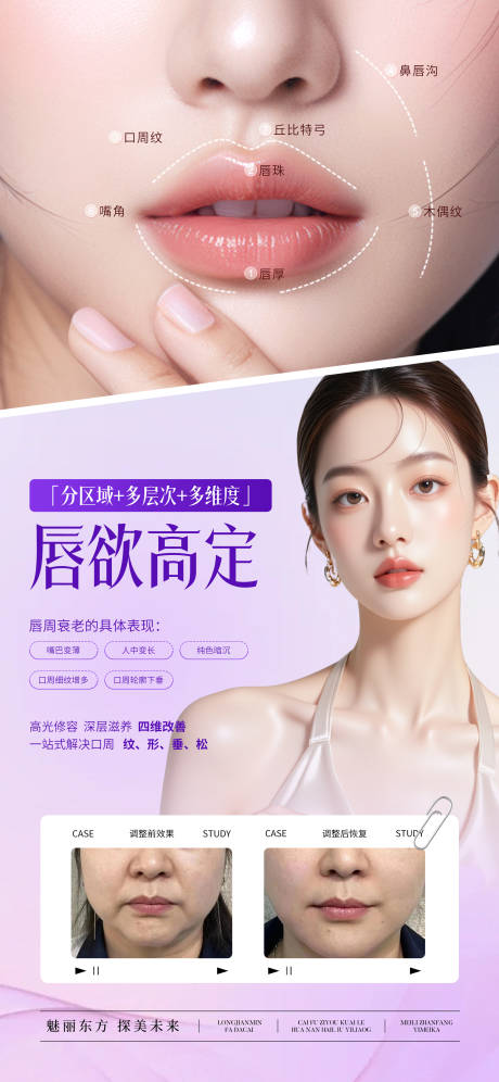源文件下载【医美唇欲高定宣传海报】编号：64790031239139696