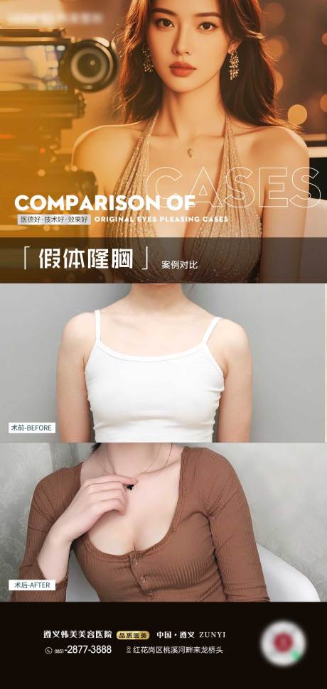 源文件下載【享設(shè)計】搜索編號：75890031177209246【醫(yī)美豐胸案例海報】