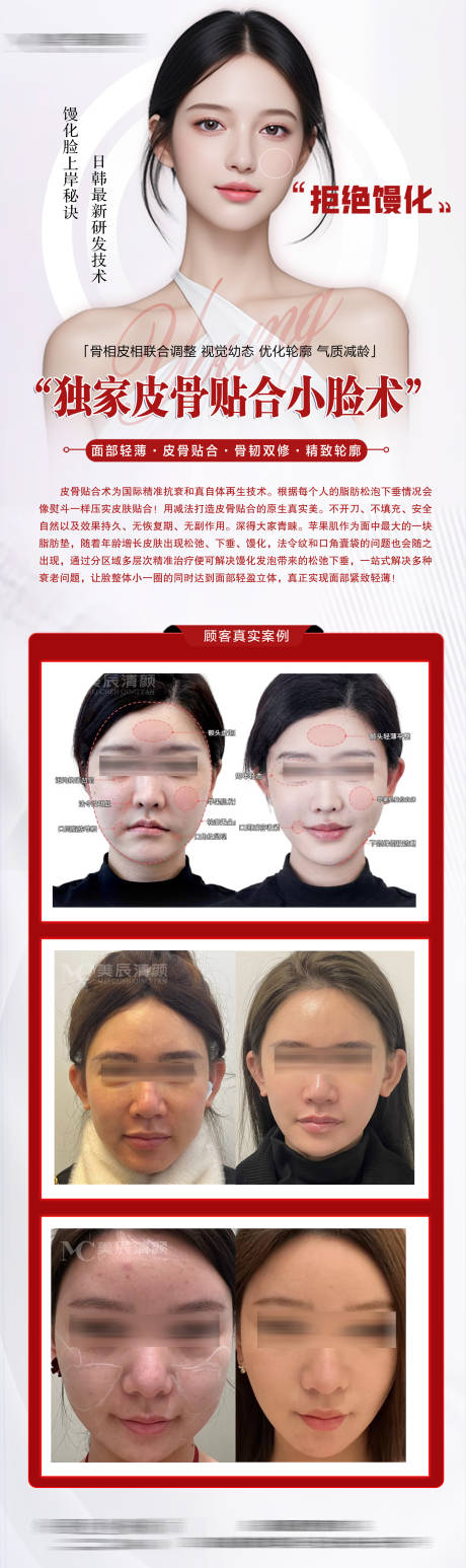 源文件下載【享設計】搜索編號：29620031476006755【醫美饅畫臉海報】