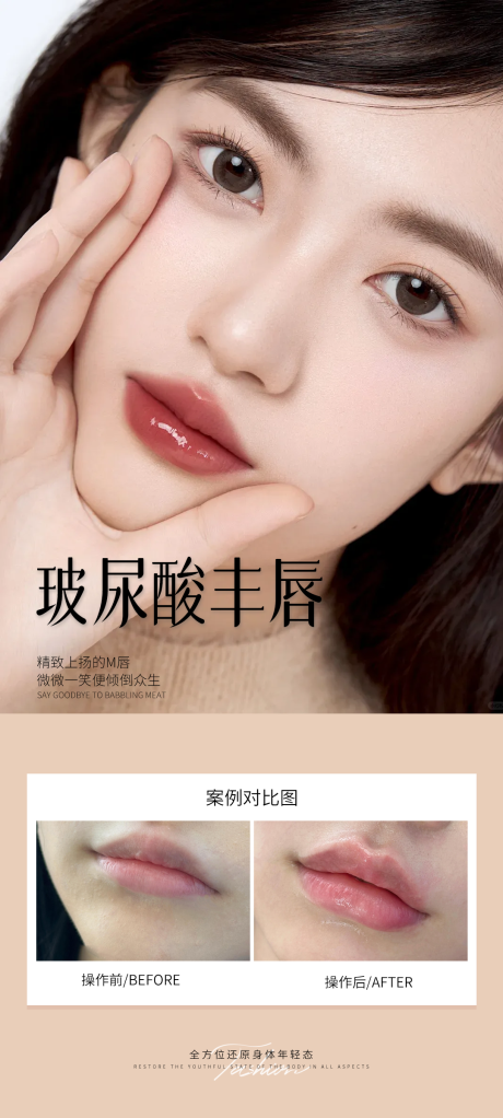 源文件下载【医美玻尿酸丰唇案例海报】编号：77230031152549180