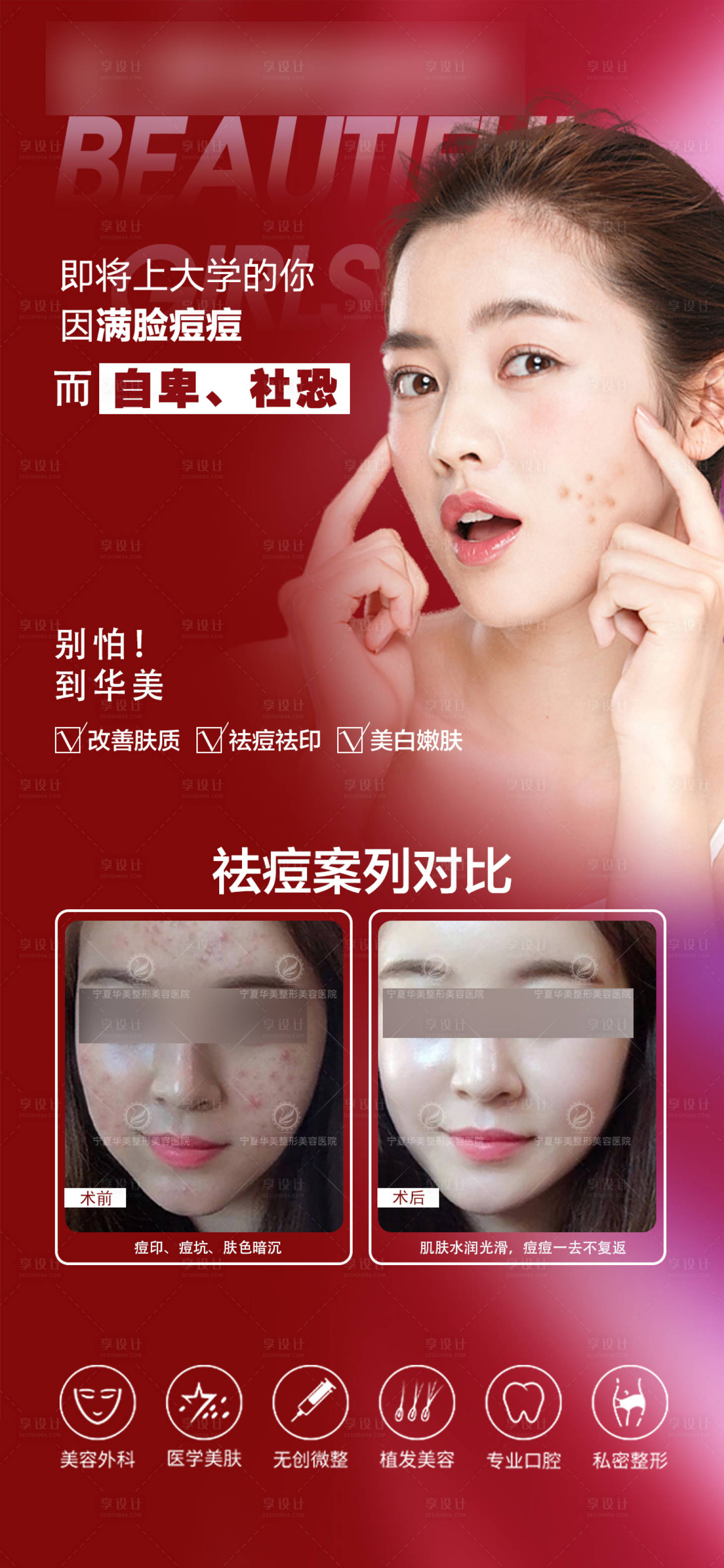 源文件下載【享設計】搜索編號：65920031261473788【醫美祛痘宣傳海報】