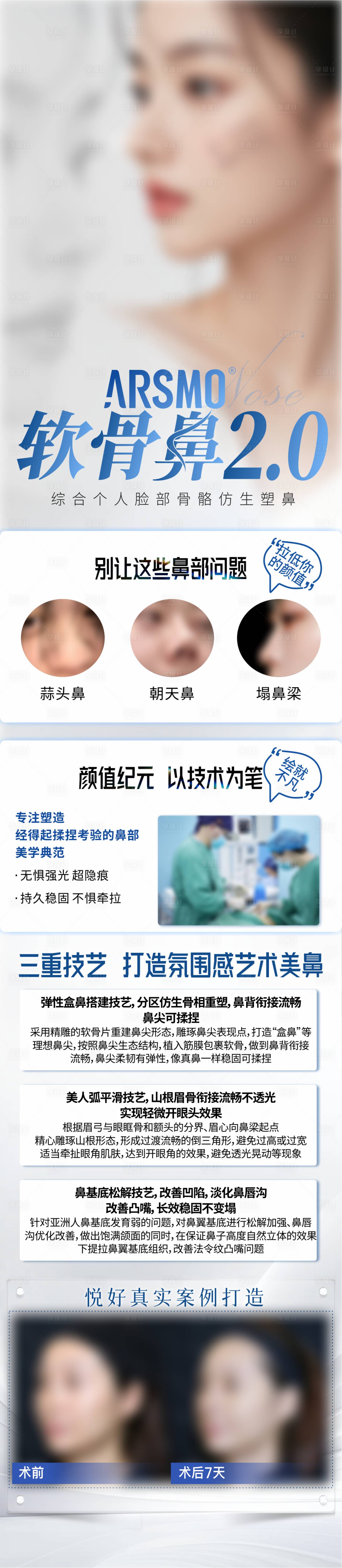 源文件下載【享設(shè)計(jì)】搜索編號(hào)：78430031409908621【醫(yī)美隆鼻案例長(zhǎng)圖】