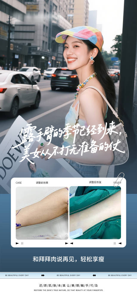 医美瘦手臂案例海报