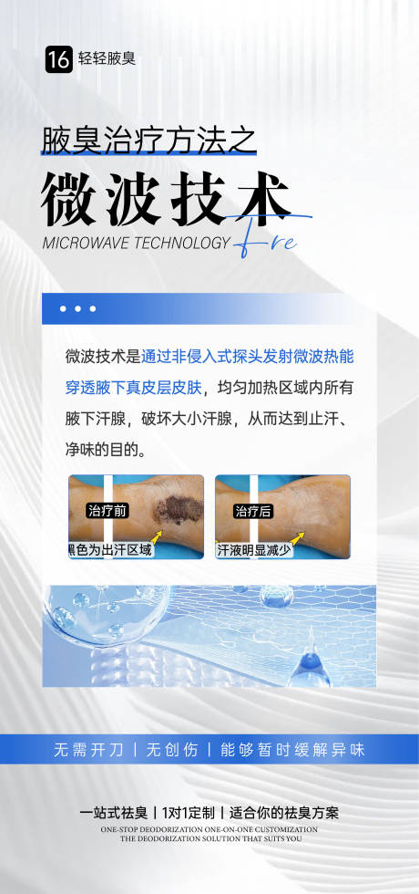 源文件下载【腋臭微波手术海报】编号：70120031314449664