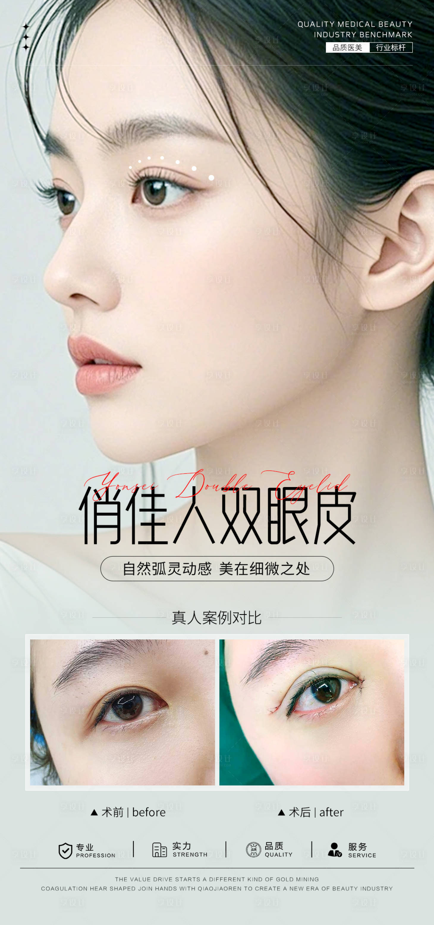 源文件下载【享设计】搜索编号：67000031600939571【双眼皮案例海报】