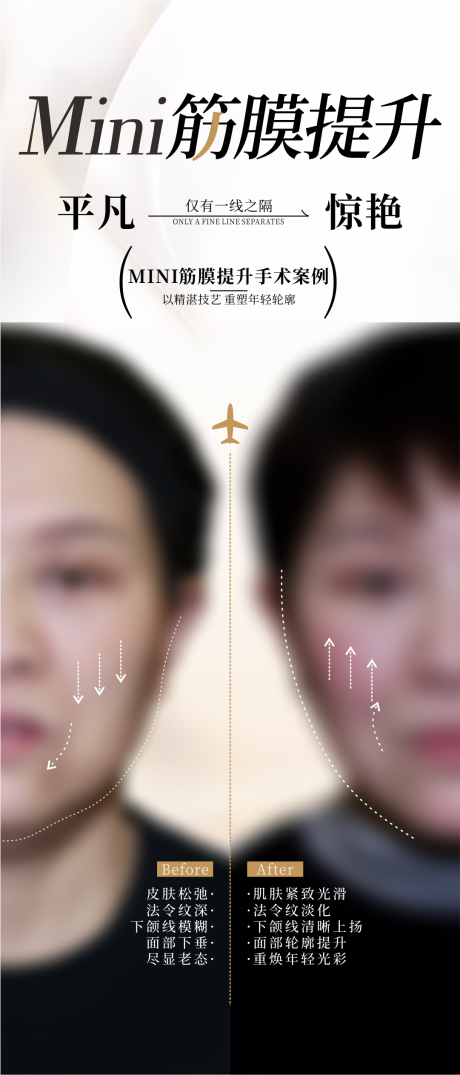 源文件下載【享設計】搜索編號：78000031409878768【筋膜提升】