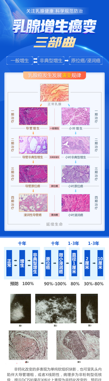源文件下载【乳腺科普】编号：58700031553836969
