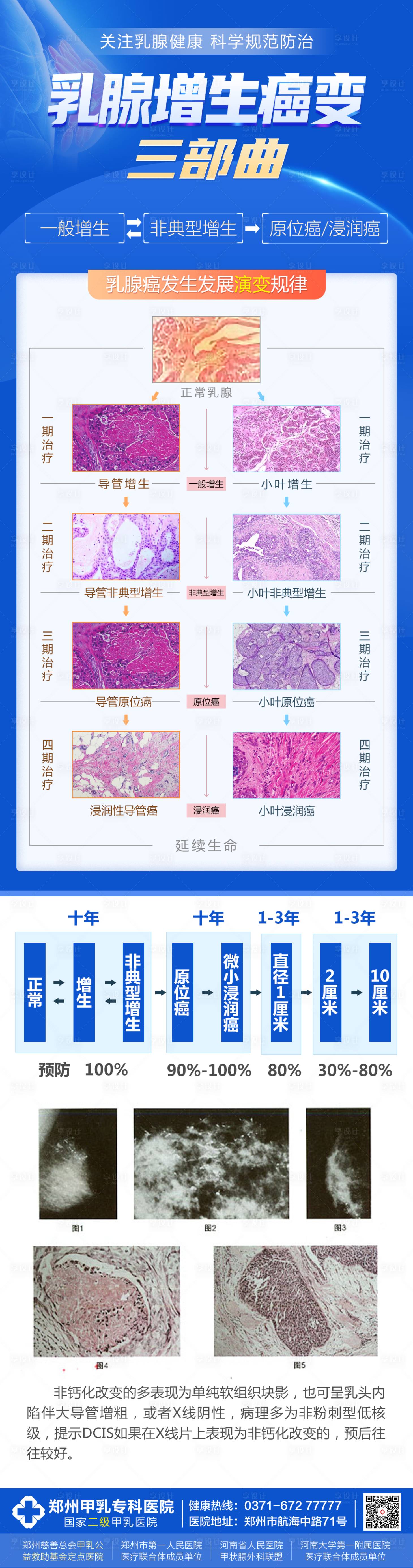 源文件下载【享设计】搜索编号：58700031553836969【乳腺科普】