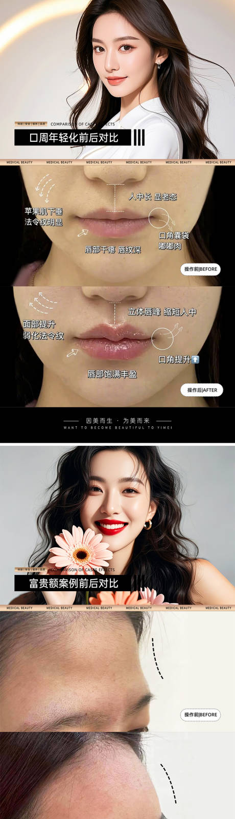 源文件下载【医美案例对比模板】编号：98270031124398264
