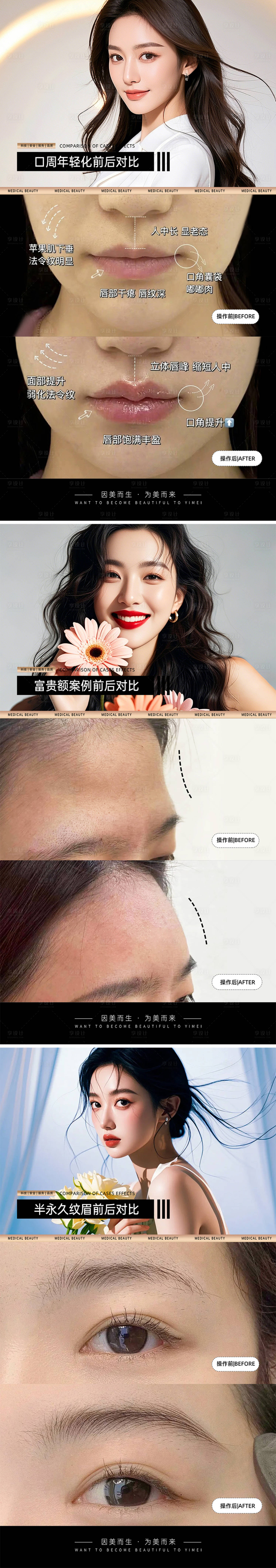 源文件下载【享设计】搜索编号：98270031124398264【医美案例对比模板】