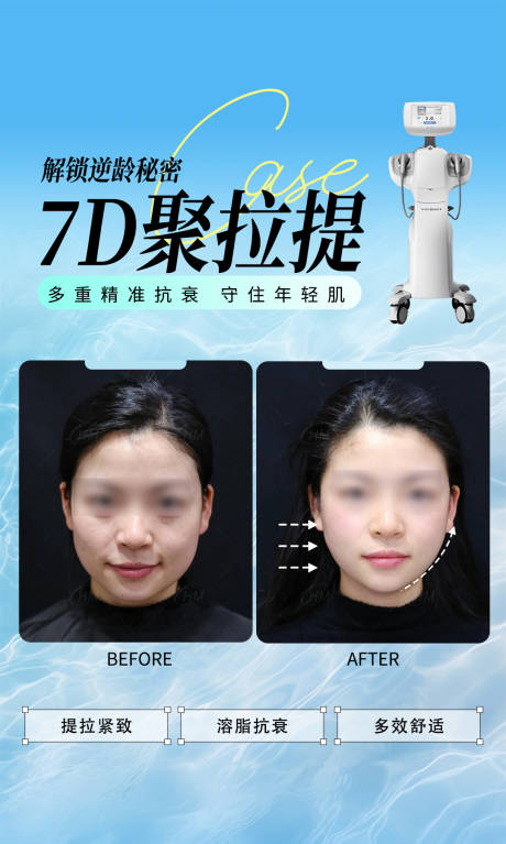 源文件下载【医美聚拉提抗衰案例海报】编号：73080031180545411