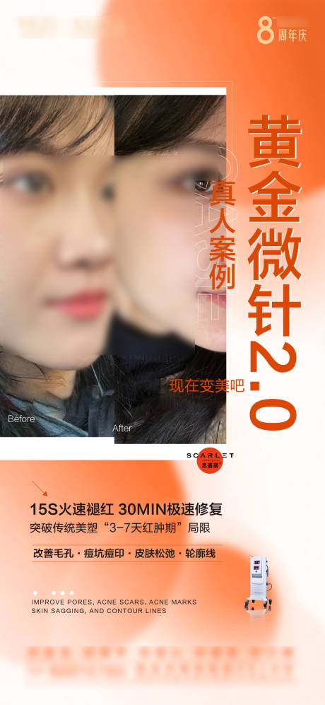 源文件下載【享設(shè)計】搜索編號：23620031599406203【黃金微針 】