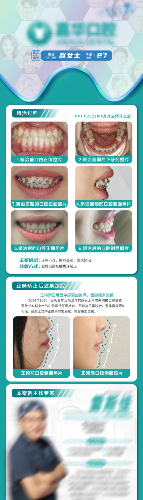 源文件下載【口腔矯正案例分析正畸案例分享】編號：41240031731669792
