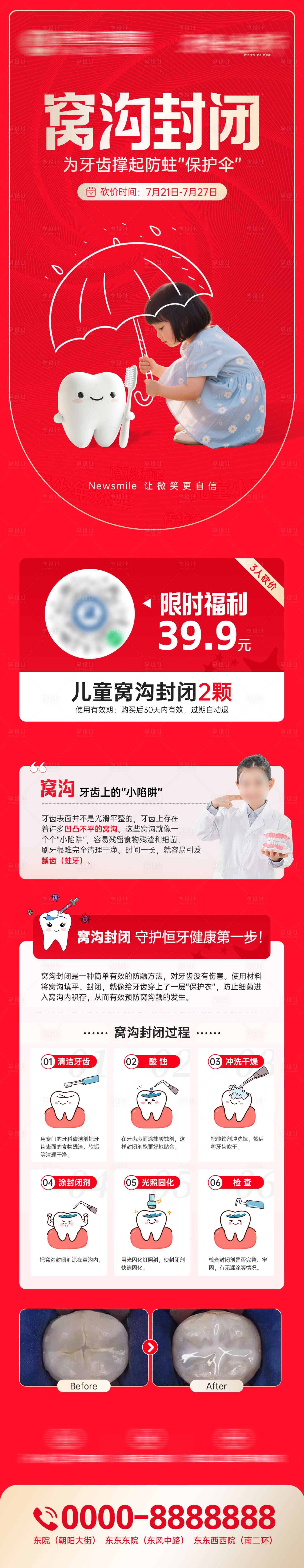 源文件下载【享设计】搜索编号：71800032195771293【窝沟封闭科普海报】
