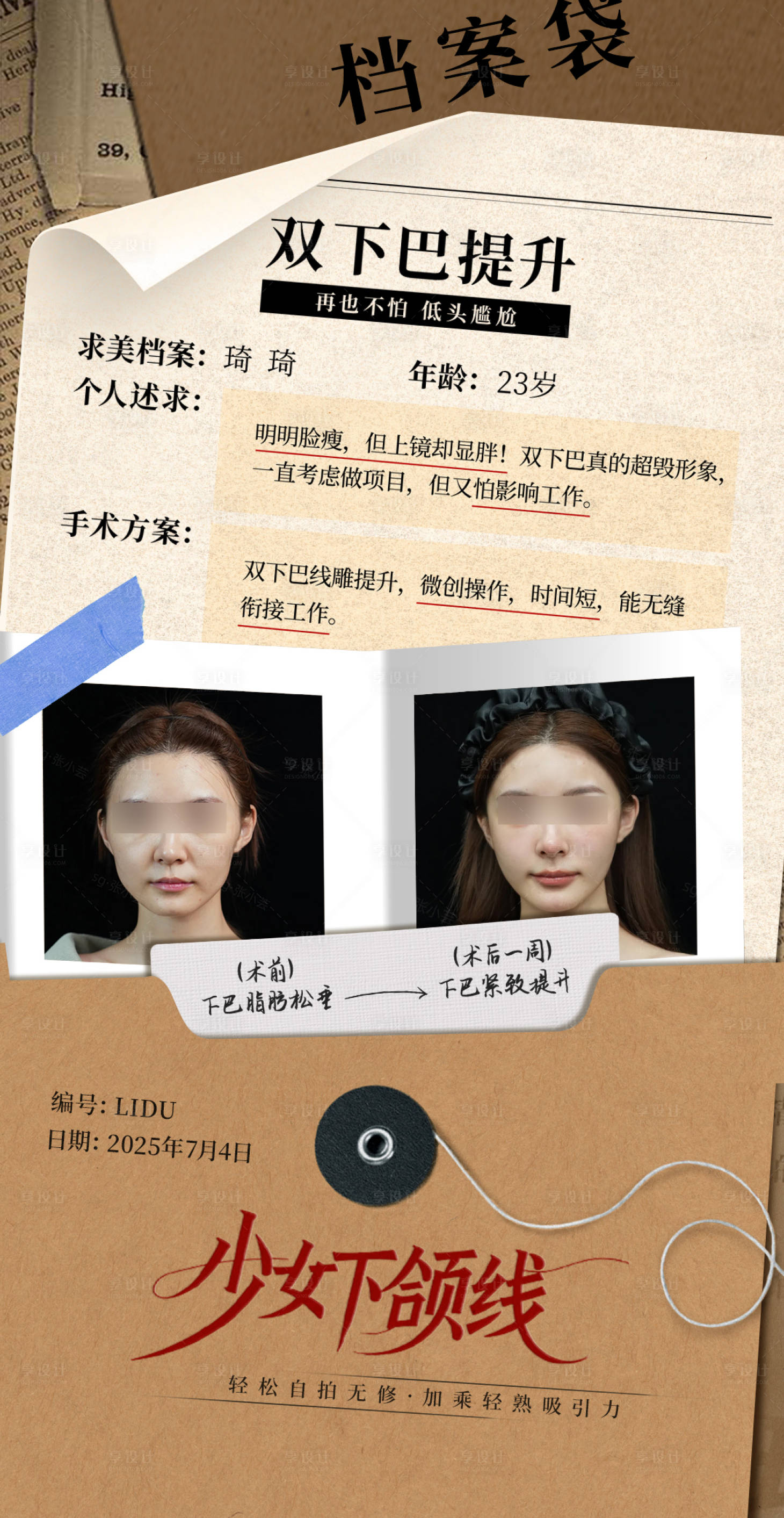 源文件下载【享设计】搜索编号：58220031749871618【医美宣传海报】