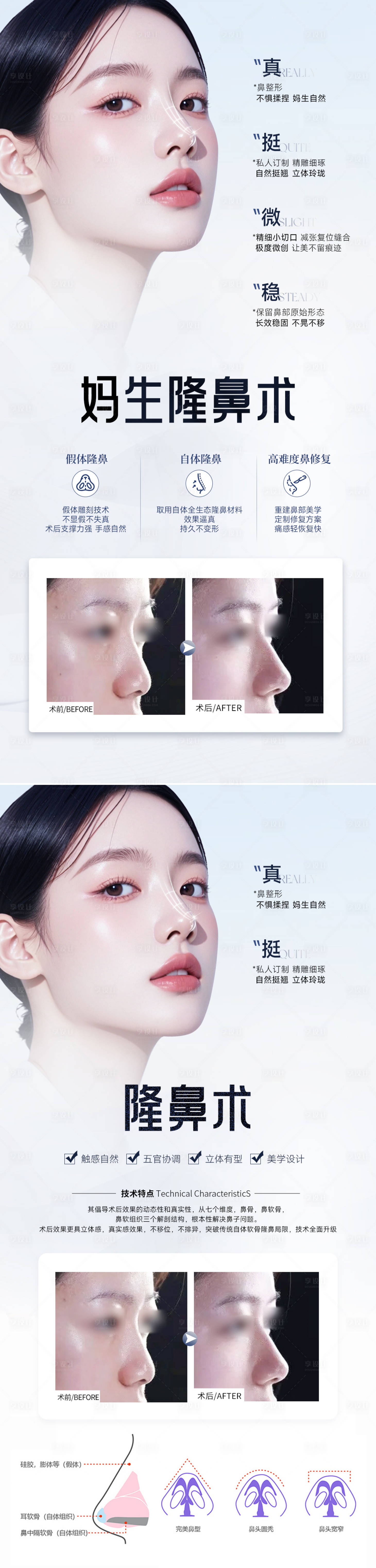 源文件下載【享設計】搜索編號：39990031814886208【醫(yī)美隆鼻整形海報】