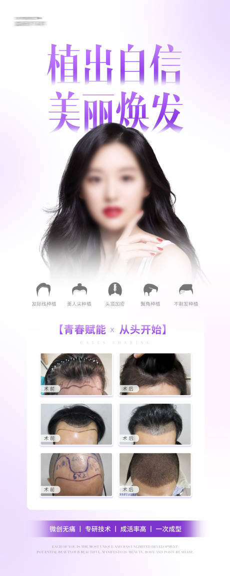 源文件下載【享設計】搜索編號：13800031862084549【植發易拉寶展架】