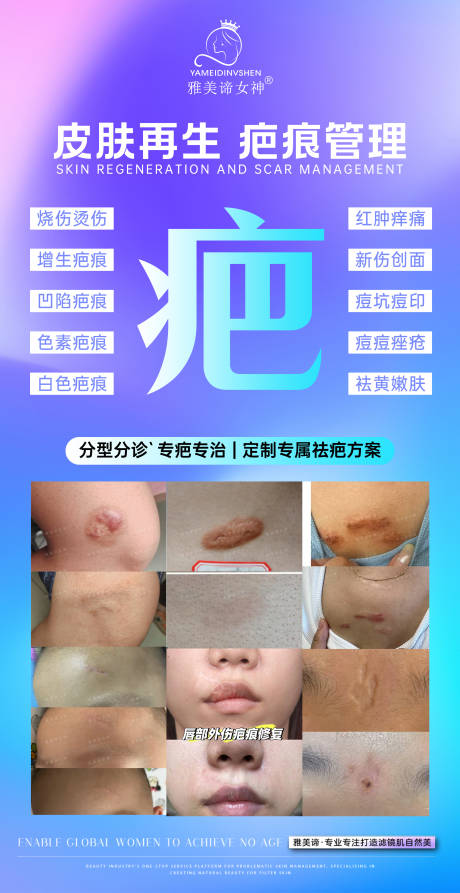 源文件下载【享设计】搜索编号：84750032131225758【美业祛疤海报】