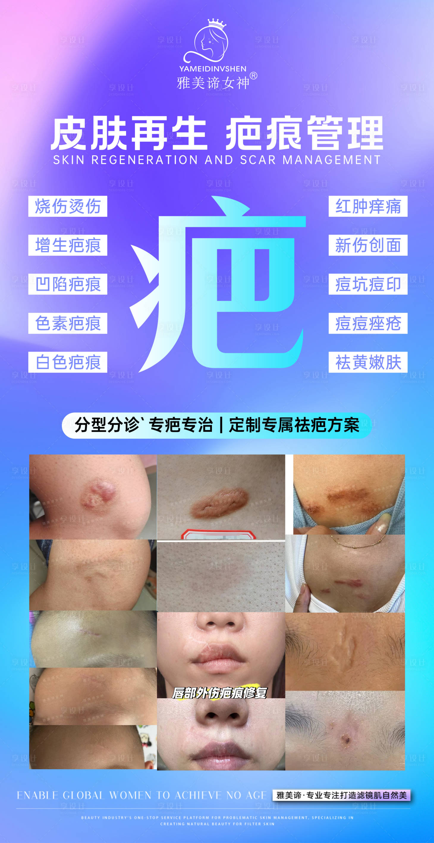 源文件下载【享设计】搜索编号：84750032131225758【美业祛疤海报】