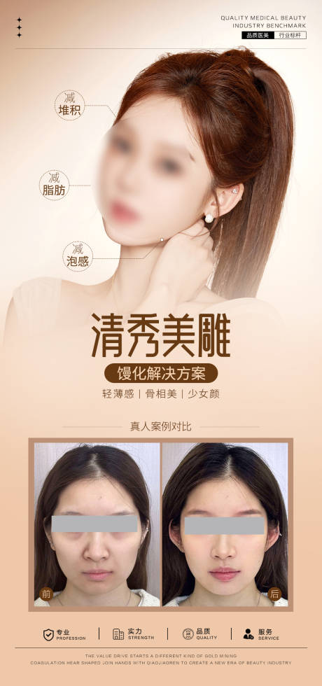 源文件下载【享设计】搜索编号：71390032119333657【清秀美雕案例对比】