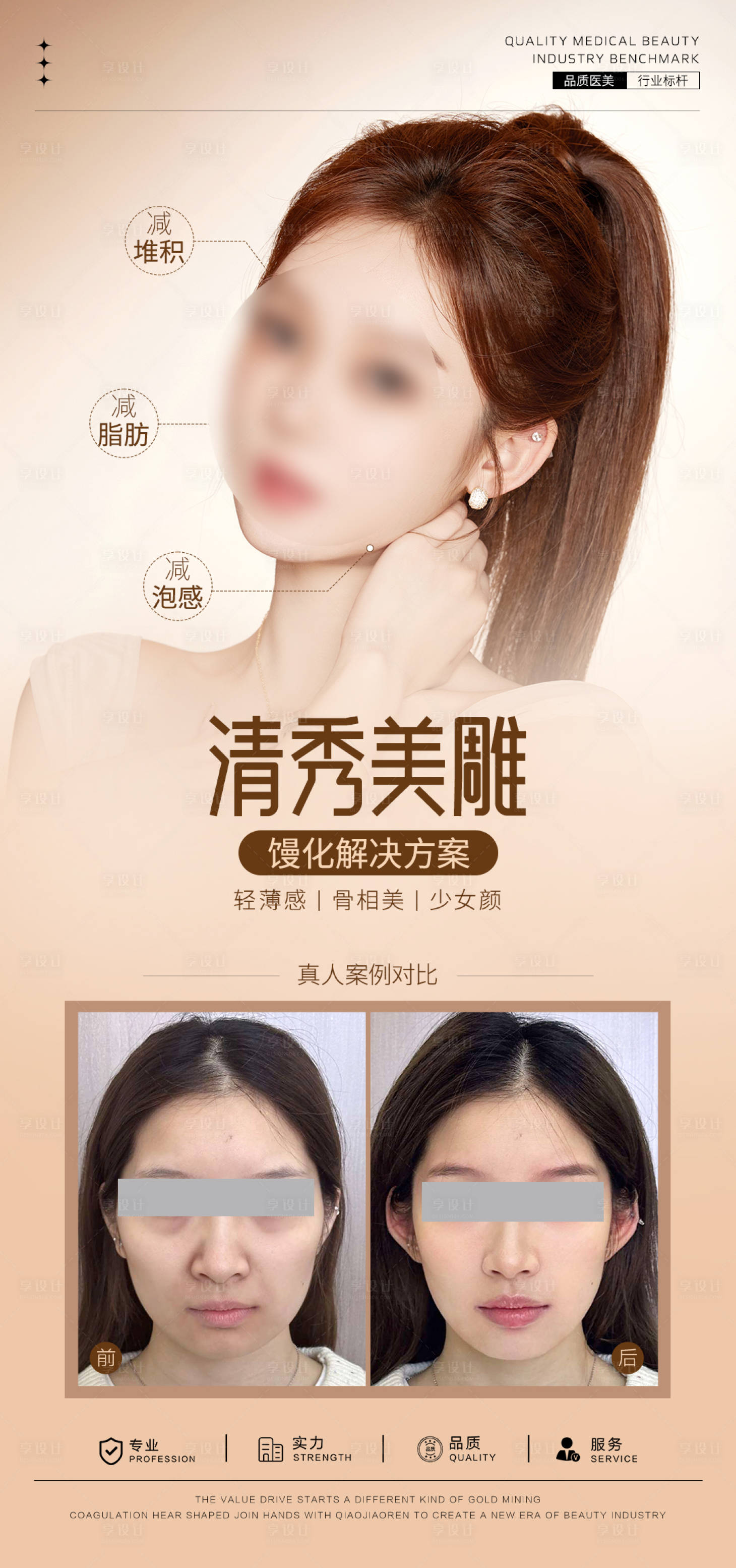 源文件下载【享设计】搜索编号：71390032119333657【清秀美雕案例对比】