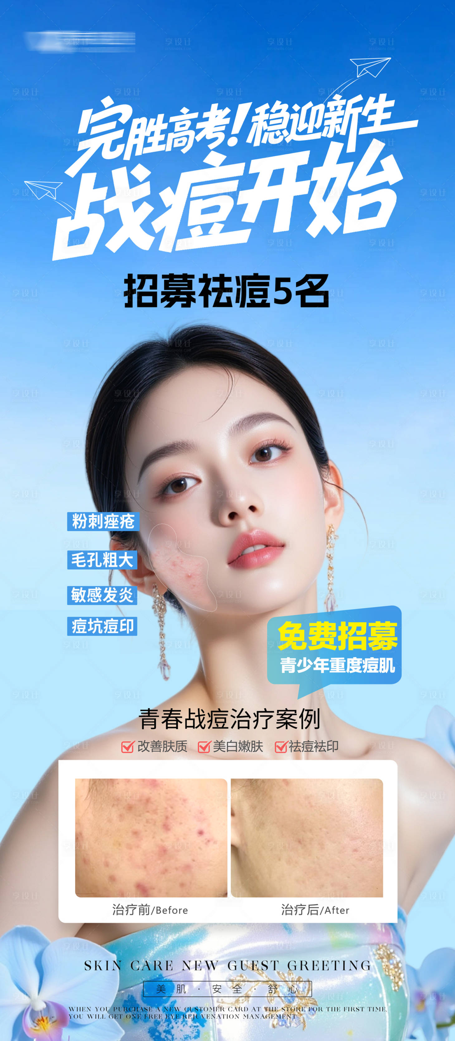 源文件下载【暑期祛痘招募展架】编号：54860032124157993