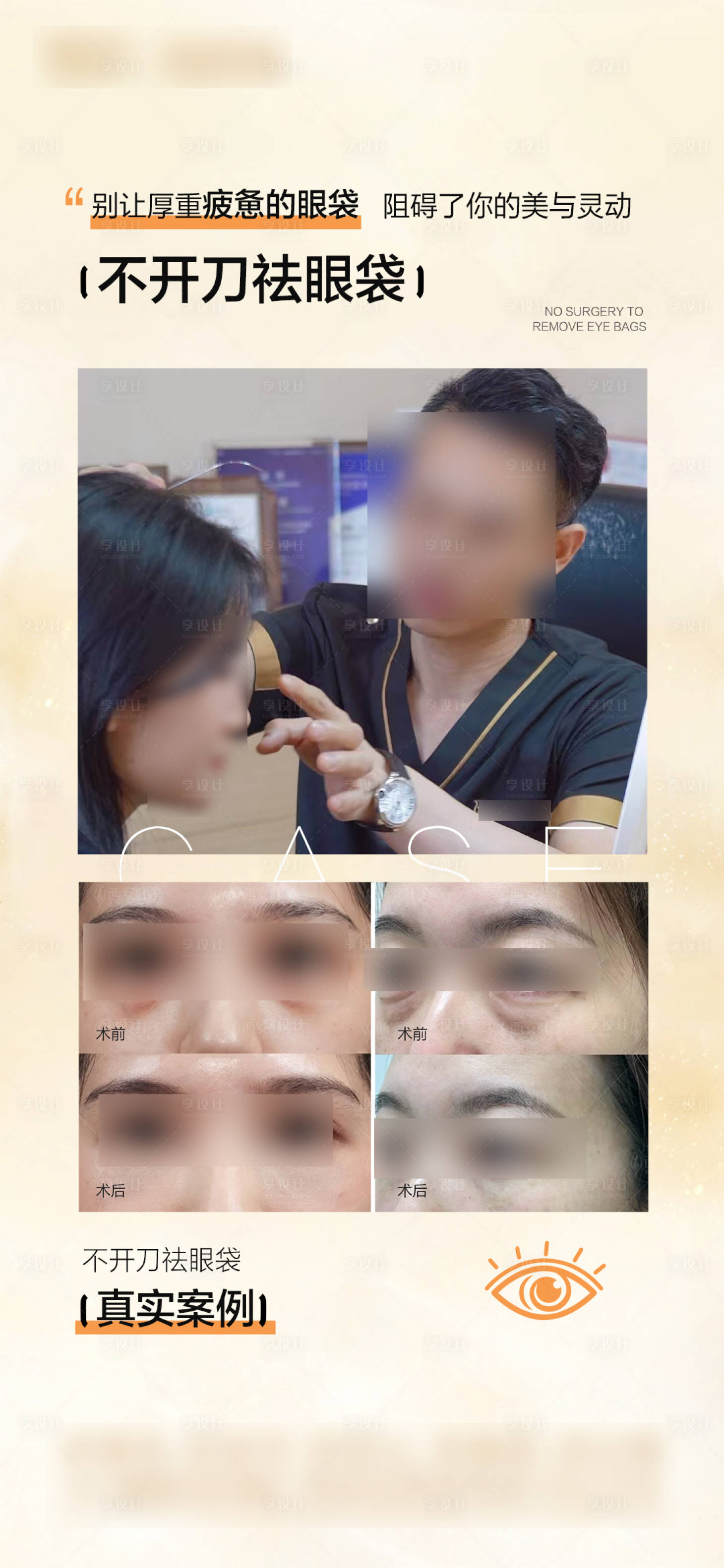 源文件下载【享设计】搜索编号：76640031852253657【医美祛眼袋案例宣传海报】
