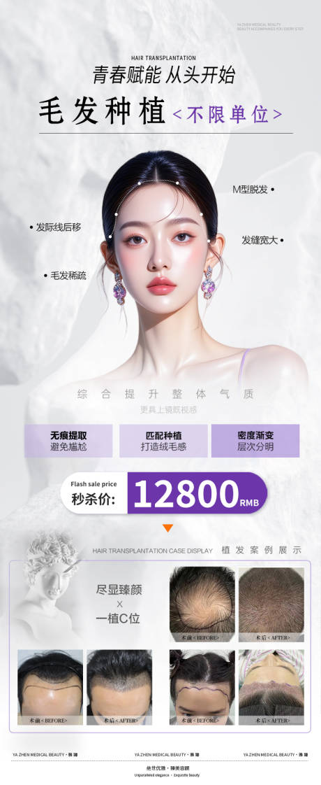 源文件下载【植发活动海报】编号：20590031909653915